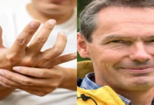 Meeno Schrader Parkinson